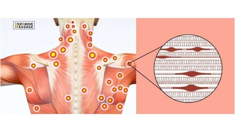 Trigger Point Therapy